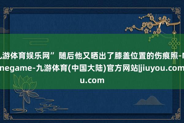 九游体育娱乐网” 随后他又晒出了膝盖位置的伤痕照-Ninegame-九游体育(中国大陆)官方网站|jiuyou.com